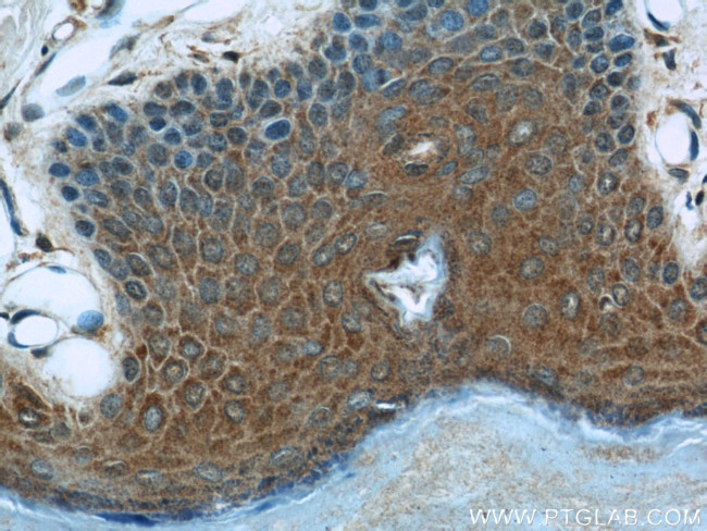 MAGED1 Antibody in Immunohistochemistry (Paraffin) (IHC (P))