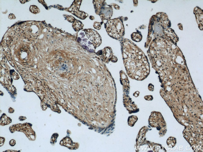 MAGED1 Antibody in Immunohistochemistry (Paraffin) (IHC (P))