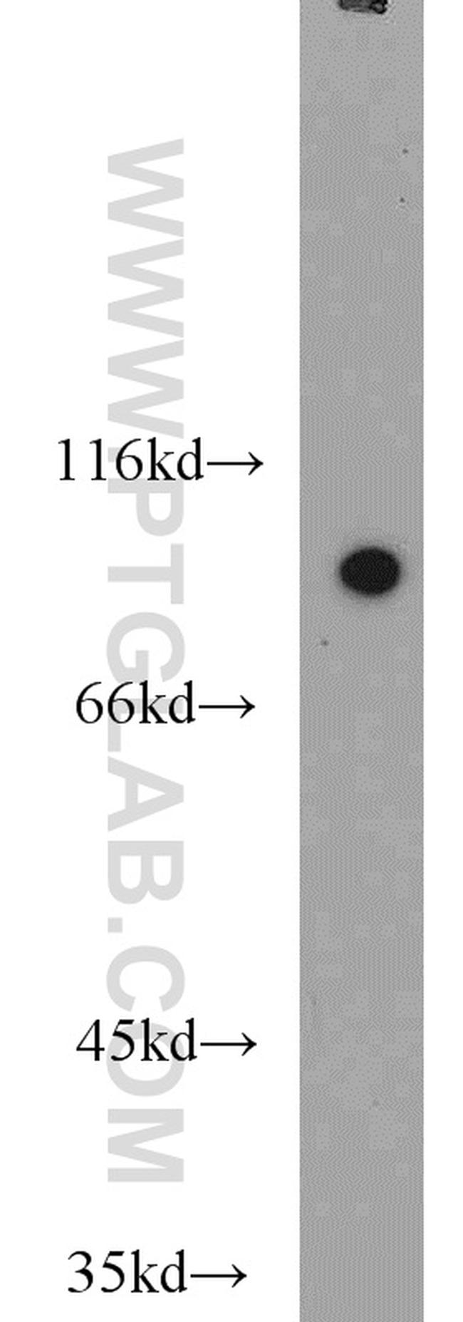 MAGED1 Antibody in Western Blot (WB)