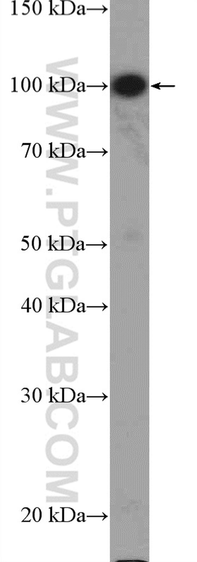 MAGED1 Antibody in Western Blot (WB)