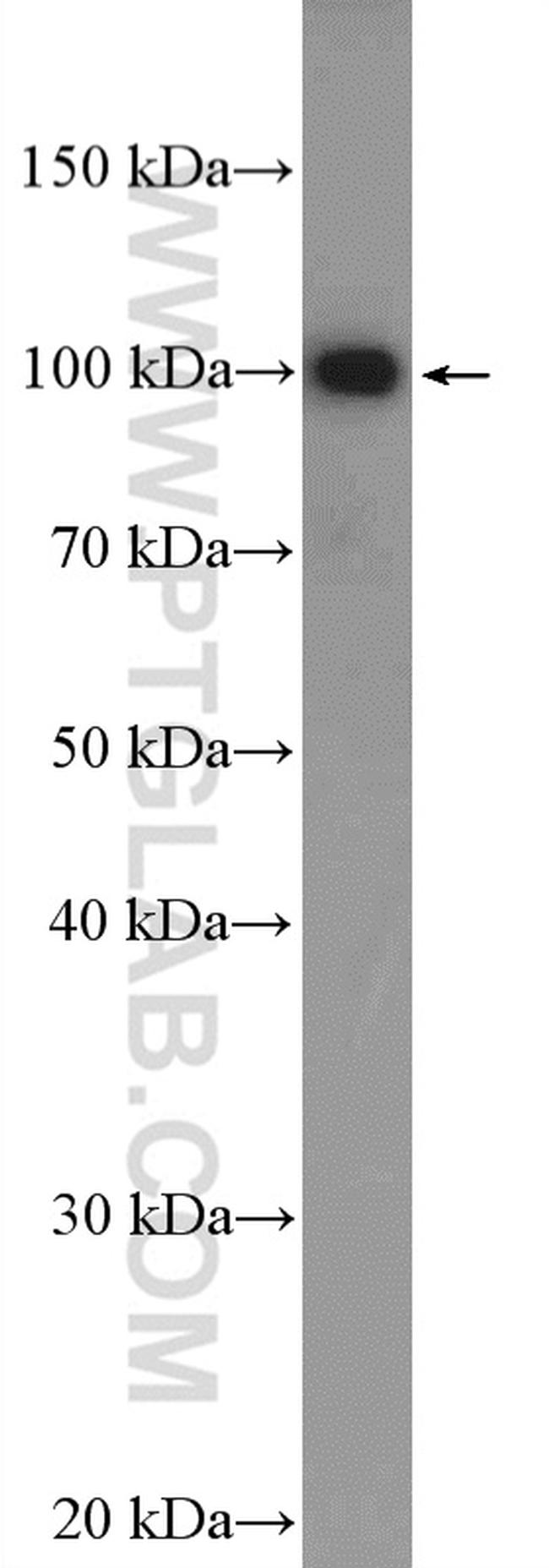 MAGED1 Antibody in Western Blot (WB)