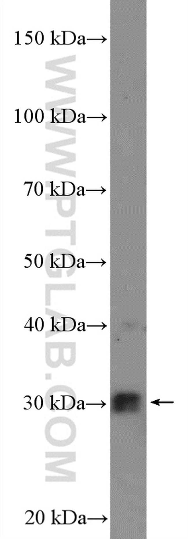 CDK2 Antibody in Western Blot (WB)