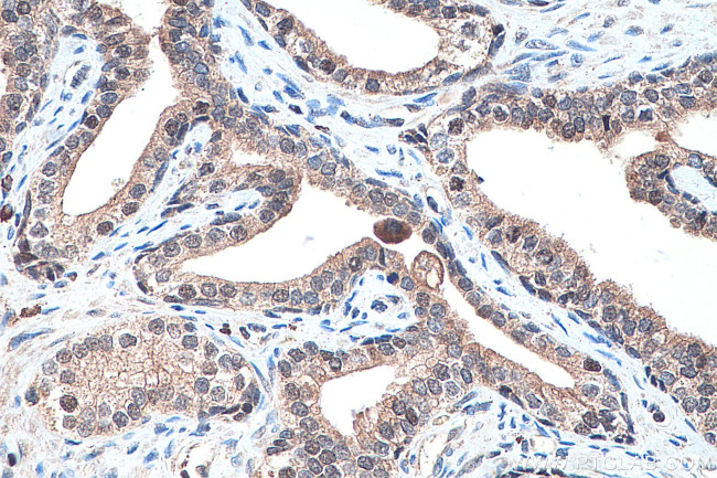 PPAR Gamma Antibody in Immunohistochemistry (Paraffin) (IHC (P))