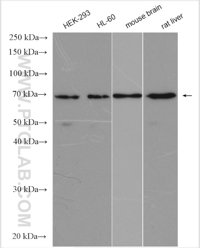 PPAR Gamma Antibody in Western Blot (WB)