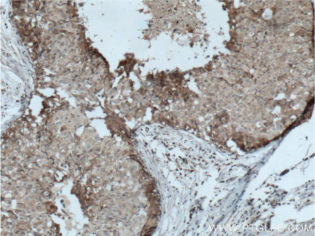 LTBP1 Antibody in Immunohistochemistry (Paraffin) (IHC (P))