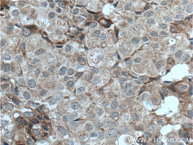 LTBP1 Antibody in Immunohistochemistry (Paraffin) (IHC (P))