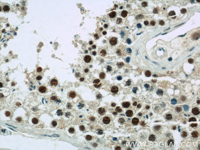 CDK8 Antibody in Immunohistochemistry (Paraffin) (IHC (P))