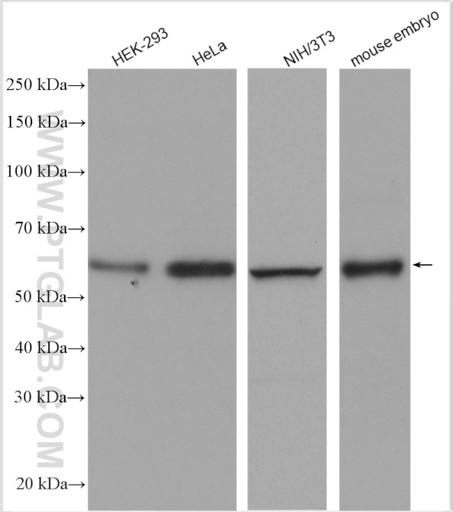 CDK8 Antibody in Western Blot (WB)