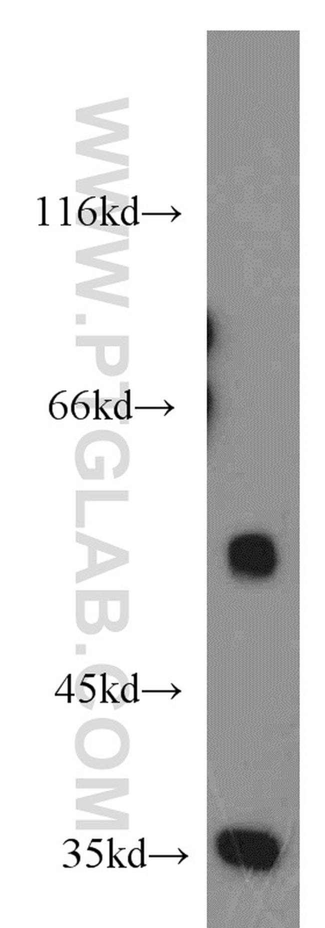 CDK8 Antibody in Western Blot (WB)