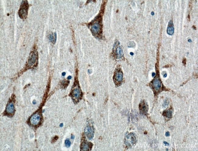 UNC5A Antibody in Immunohistochemistry (Paraffin) (IHC (P))