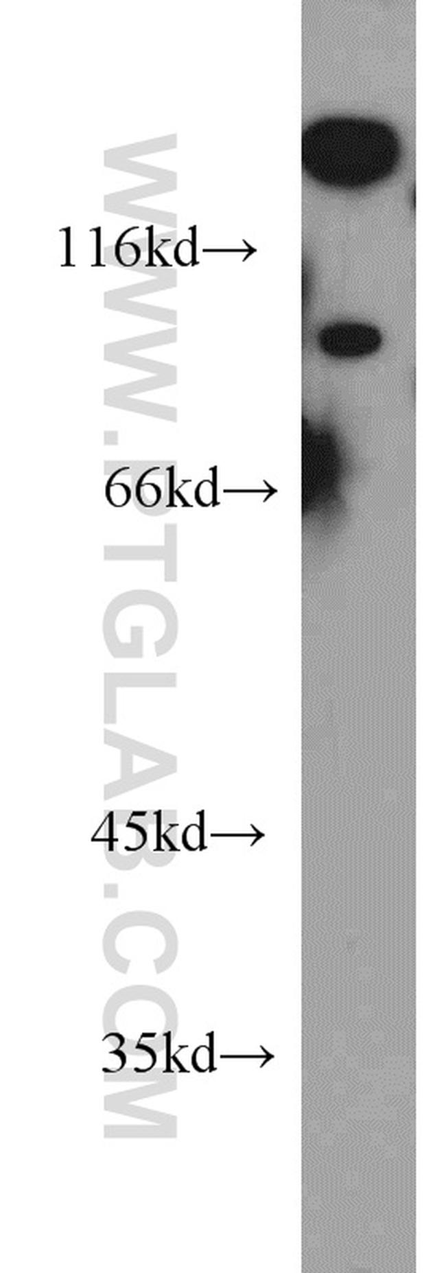 UNC5A Antibody in Western Blot (WB)