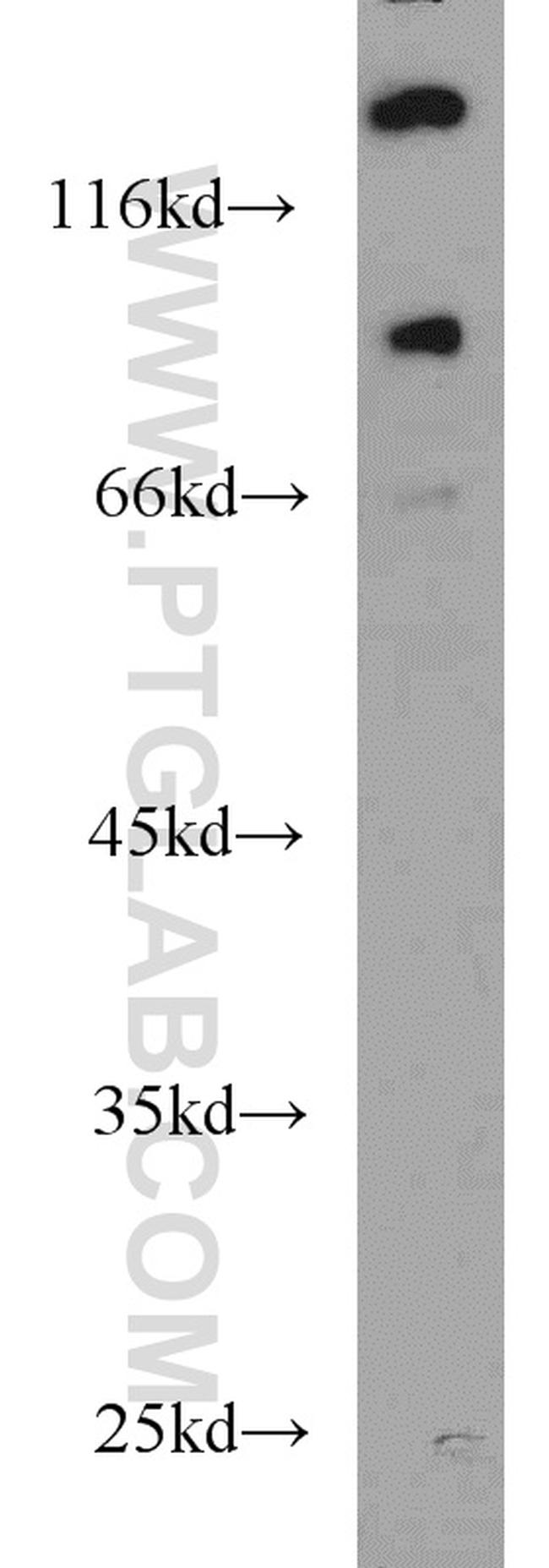 UNC5A Antibody in Western Blot (WB)