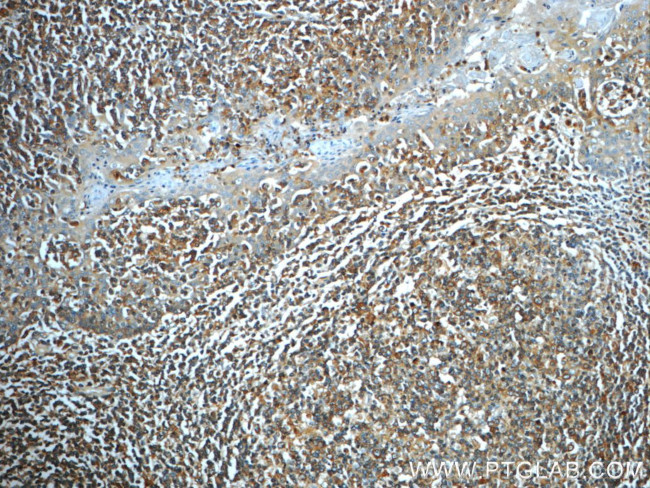 IMPDH1 Antibody in Immunohistochemistry (Paraffin) (IHC (P))