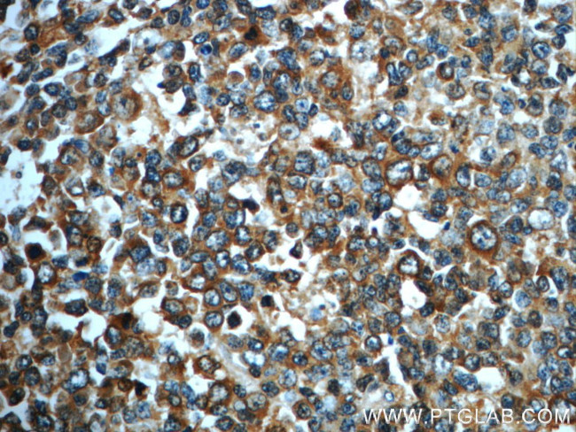 IMPDH1 Antibody in Immunohistochemistry (Paraffin) (IHC (P))