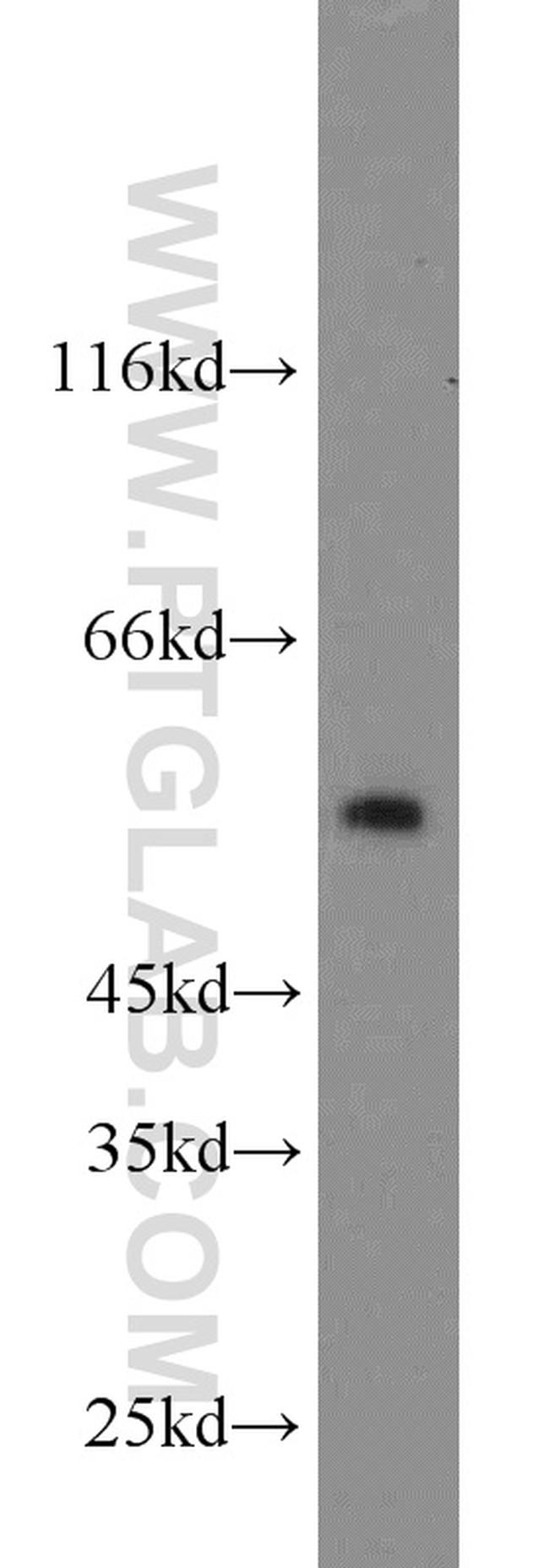 IMPDH1 Antibody in Western Blot (WB)