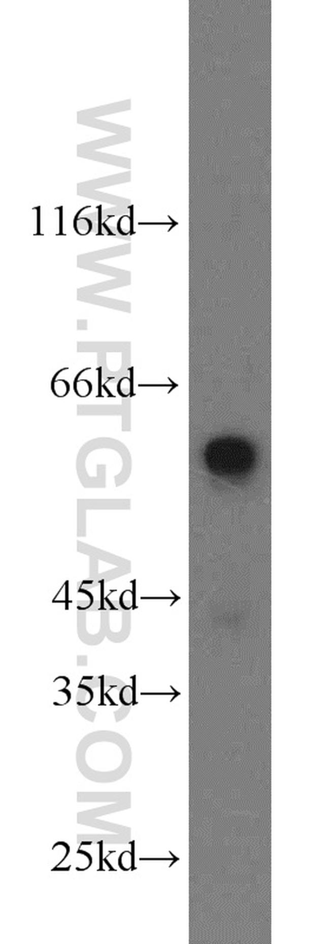 IMPDH1 Antibody in Western Blot (WB)