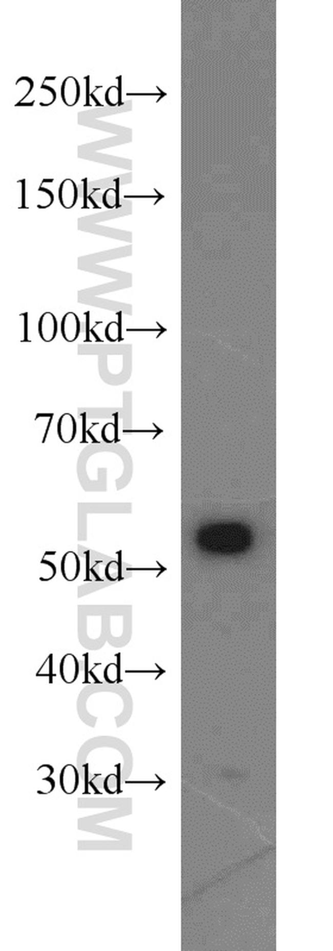 IMPDH1 Antibody in Western Blot (WB)