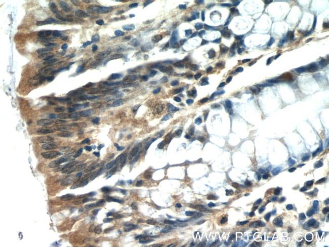 ISG20 Antibody in Immunohistochemistry (Paraffin) (IHC (P))