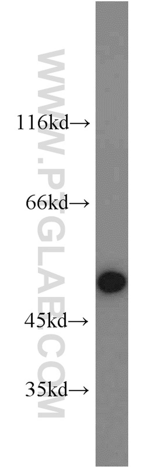 RBM22 Antibody in Western Blot (WB)