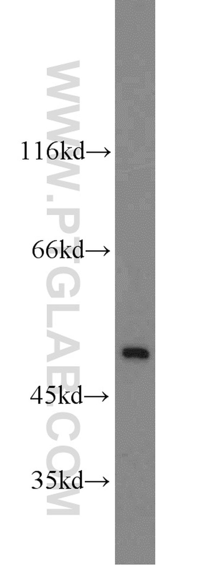 RBM22 Antibody in Western Blot (WB)