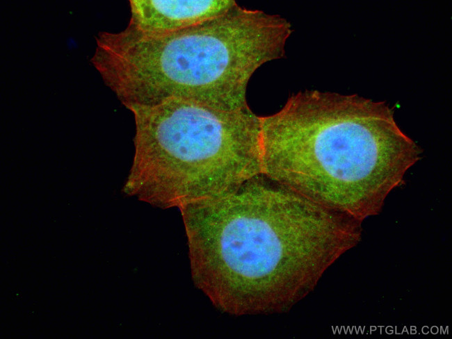 GSK3B Antibody in Immunocytochemistry (ICC/IF)