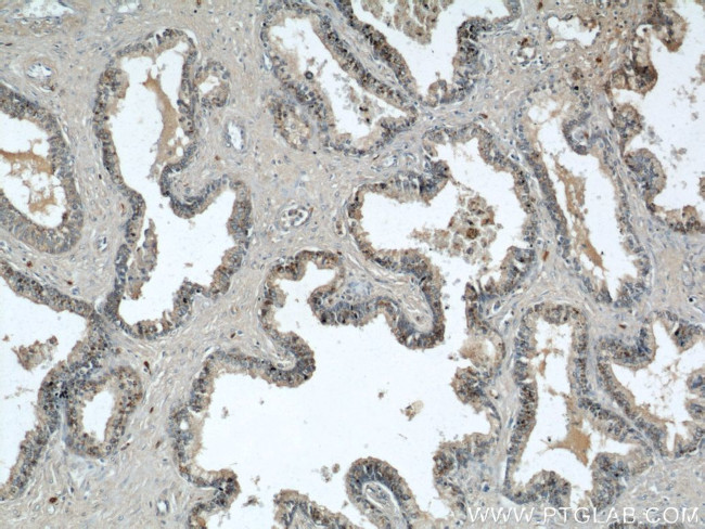 GSK3B Antibody in Immunohistochemistry (Paraffin) (IHC (P))