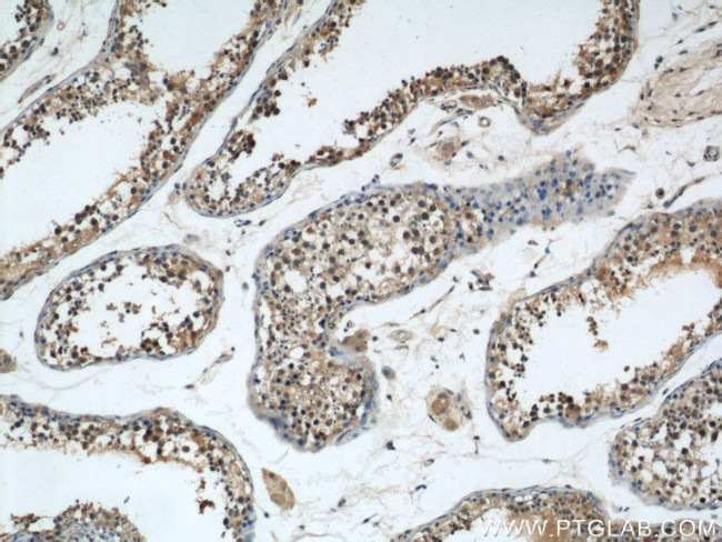 GSK3B Antibody in Immunohistochemistry (Paraffin) (IHC (P))