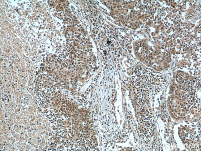 GSK3B Antibody in Immunohistochemistry (Paraffin) (IHC (P))