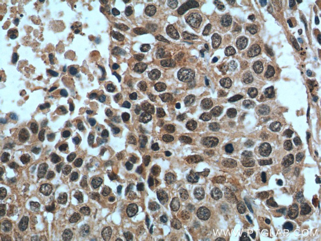 GSK3B Antibody in Immunohistochemistry (Paraffin) (IHC (P))