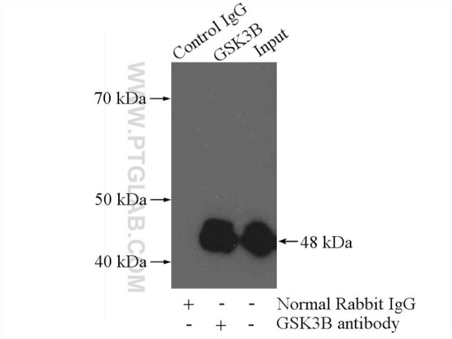 GSK3B Antibody in Immunoprecipitation (IP)