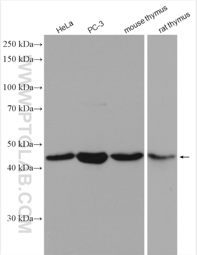 GSK3B Antibody in Western Blot (WB)