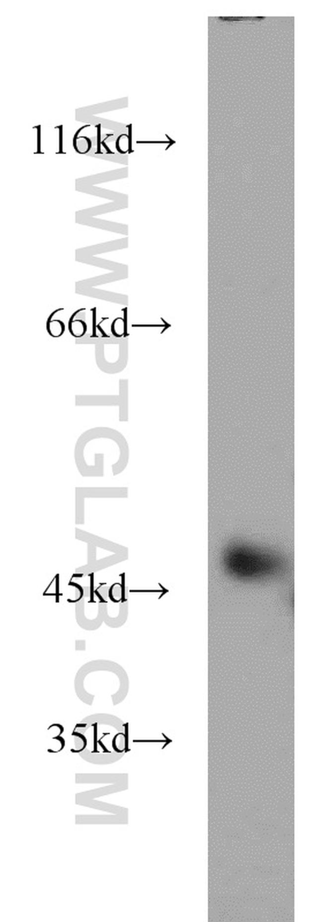 GSK3B Antibody in Western Blot (WB)