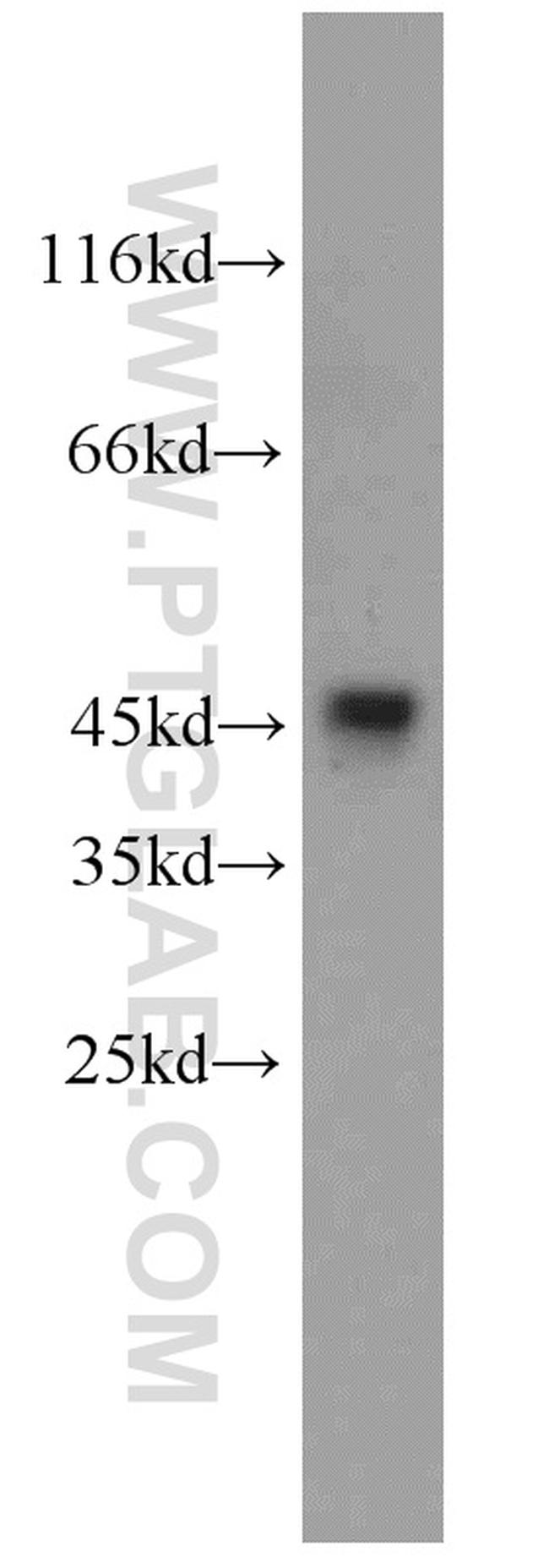 GSK3B Antibody in Western Blot (WB)