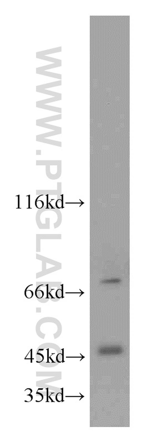 GSK3B Antibody in Western Blot (WB)