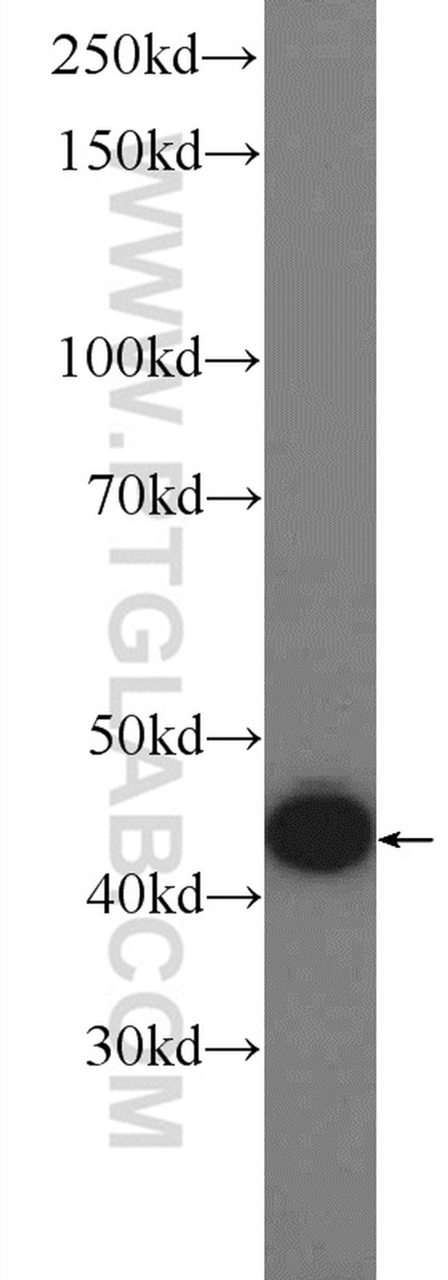 GSK3B Antibody in Western Blot (WB)