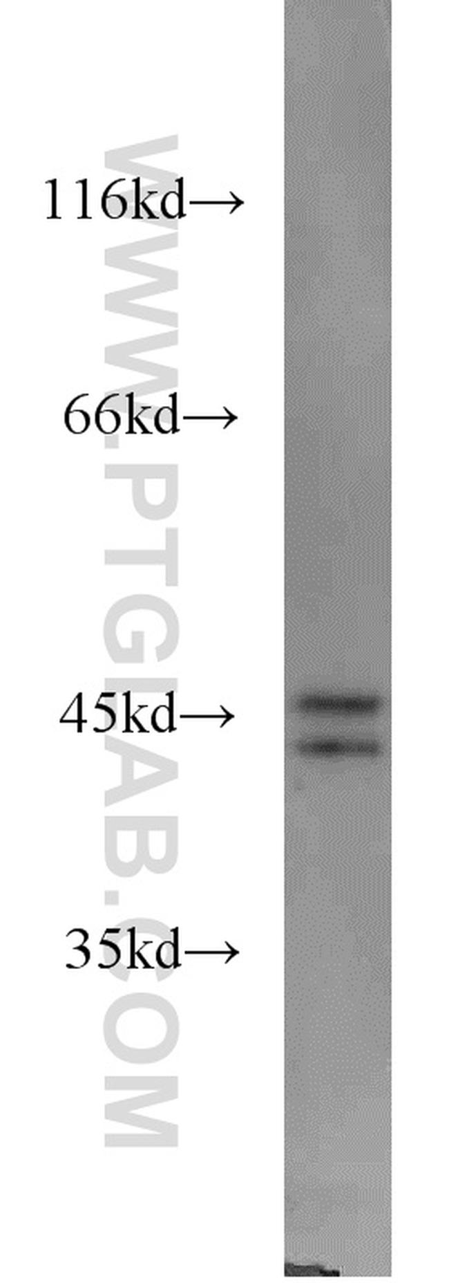 GSK3B Antibody in Western Blot (WB)