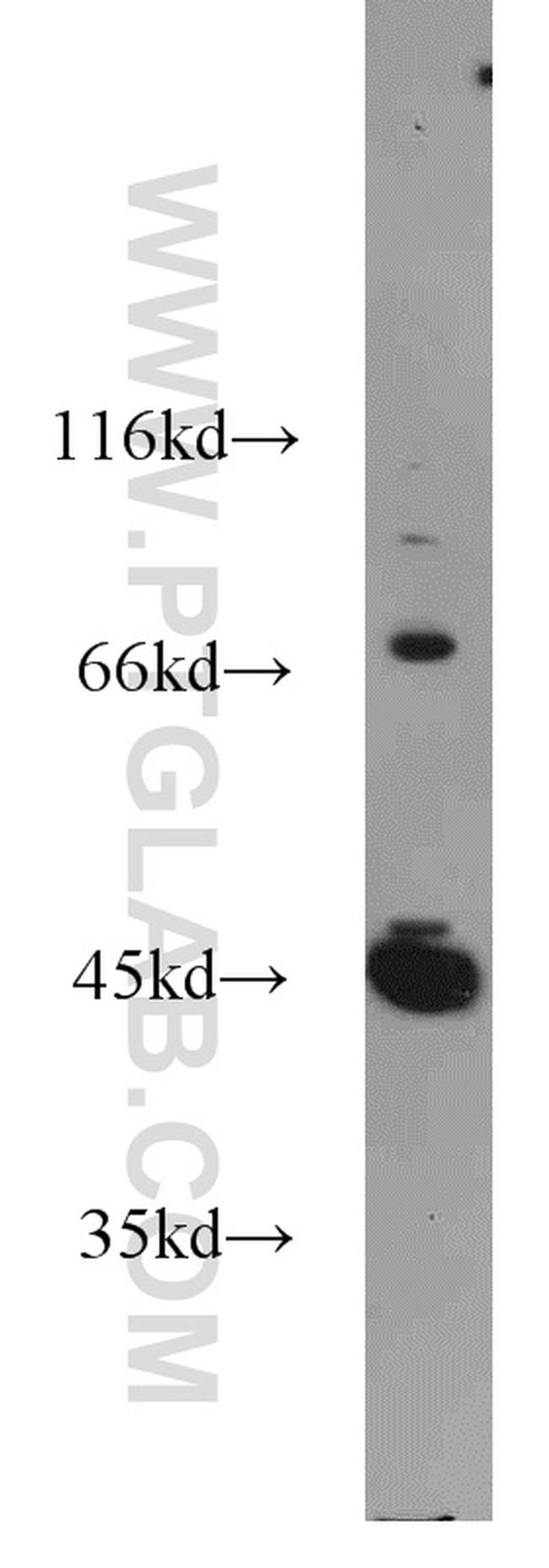 GSK3B Antibody in Western Blot (WB)