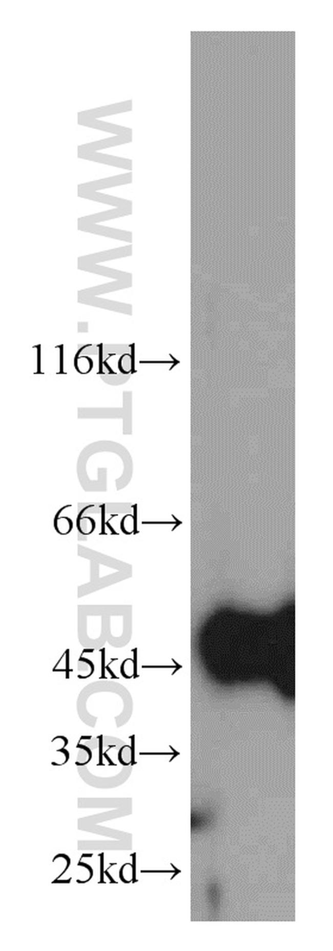 GSK3B Antibody in Western Blot (WB)