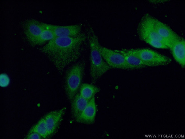 ALDH1A1 Antibody in Immunocytochemistry (ICC/IF)