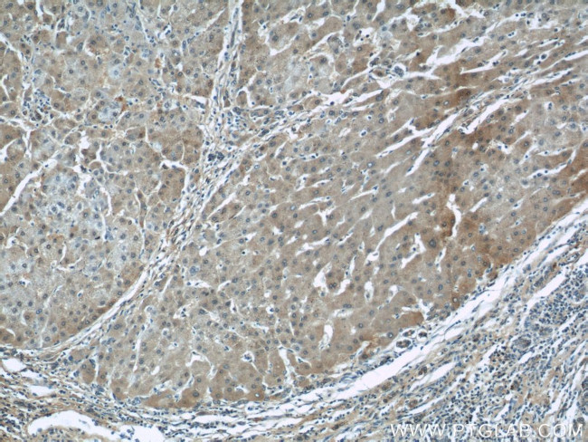 ALDH1A1 Antibody in Immunohistochemistry (Paraffin) (IHC (P))