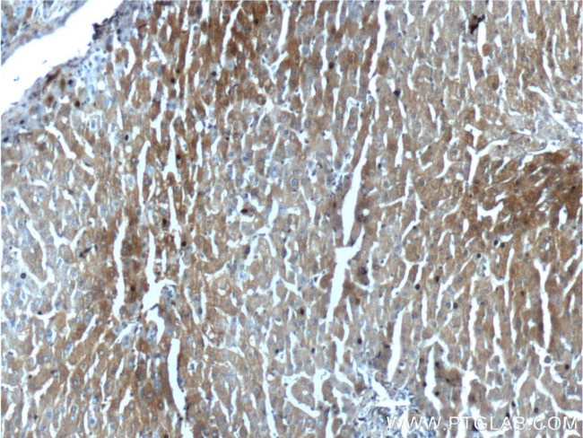 ALDH1A1 Antibody in Immunohistochemistry (Paraffin) (IHC (P))