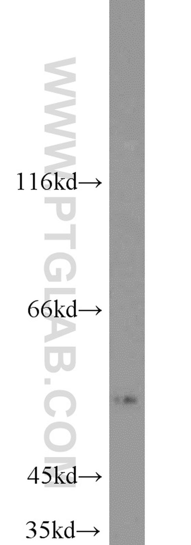 ALDH1A1 Antibody in Western Blot (WB)