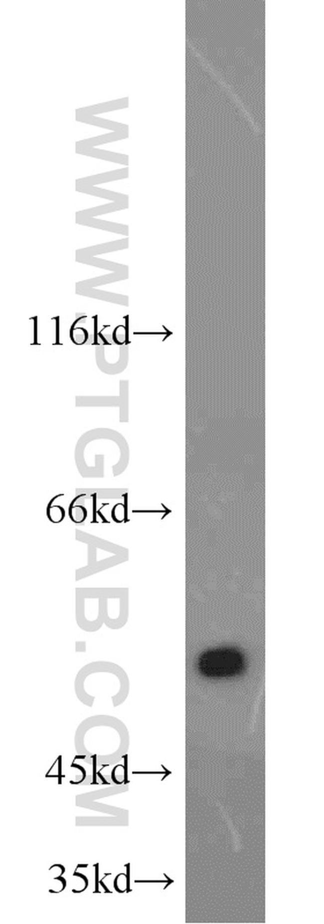 ALDH1A1 Antibody in Western Blot (WB)