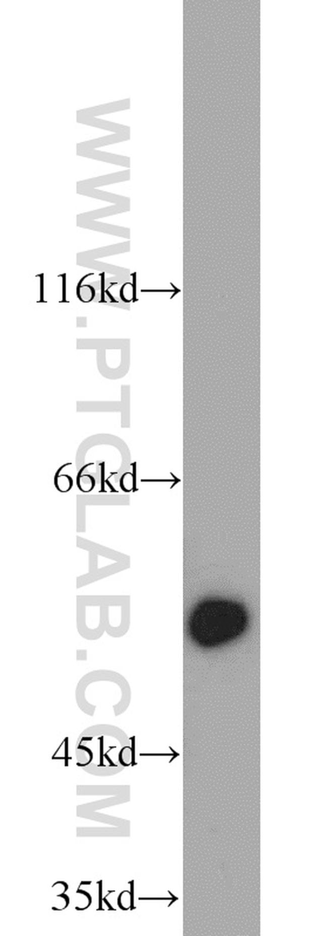 ALDH1A1 Antibody in Western Blot (WB)