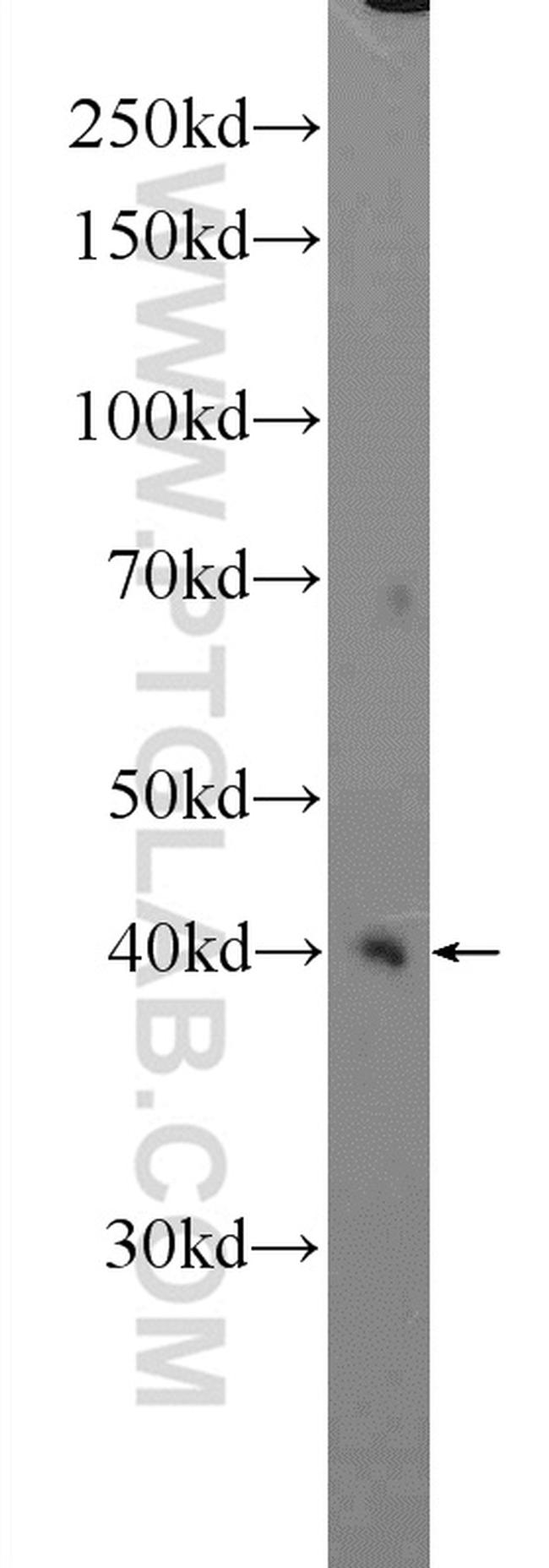 AP1/JUN/P39 Antibody in Western Blot (WB)