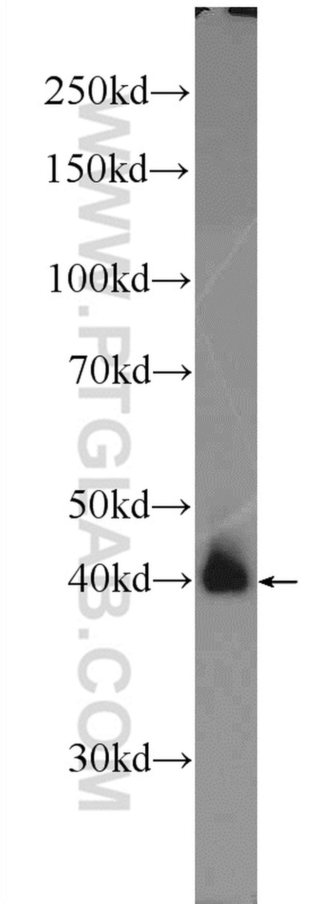 AP1/JUN/P39 Antibody in Western Blot (WB)