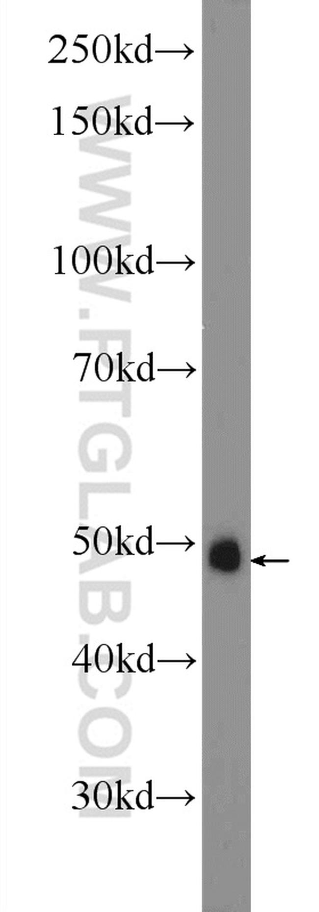 AP1/JUN/P39 Antibody in Western Blot (WB)