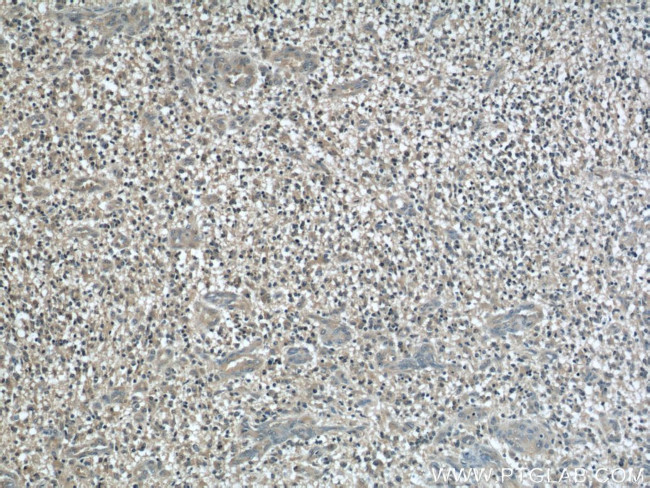 MYPT1 Antibody in Immunohistochemistry (Paraffin) (IHC (P))