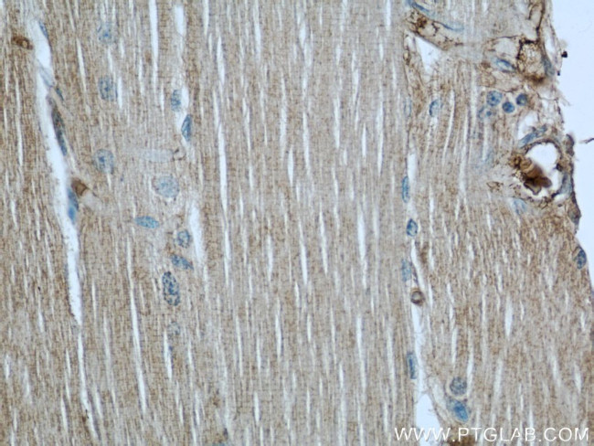 MYPT1 Antibody in Immunohistochemistry (Paraffin) (IHC (P))