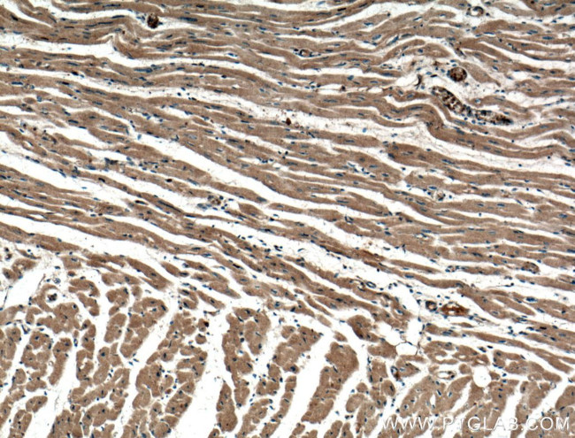 MYPT1 Antibody in Immunohistochemistry (Paraffin) (IHC (P))